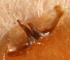 CollectionObject 1517125; 671965bf-7459-405b-a74c-3cf8f193a2cf: male titillator (holotype). (CollectionObject).