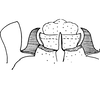 Pygofer ventral appendages, ventral view on Arboridia (Arboridia) ribauti (Ossiannilsson, 1937): Pygofer processes, ventral view. (Observation).