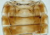 Abdomen, sternal apodemes, ventral view: (Observation).