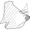 Pygofer, lateral view on Bolanusoides yinxiong Dworakowska, 1993: Pygofer lobe, lateral view. (Observation).