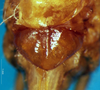 CollectionObject 1589084; fceee817-29be-48e1-923f-d37874f72c74: female subgenital plate (allotype). (CollectionObject).