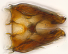 Subgenital plate: (Observation).