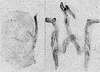 Other: !! display not done !! on Eratoneura mensa (Beamer, 1931): Pygofer lobe, aedeagus, connective, and styli. (Observation).