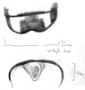 Brachyteleutias steinbachi (Bruner, 1915): original drawing. male, end tergite (dorsal) and supra-anal plate (caudal view, specimen in ANSP collection). (Otu).