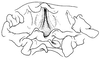 Subria sylvestris Naskrecki & Morris, 2000: male genitalia. (Otu).