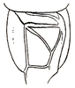Orchelimum (Metarhoptrum) fraternum Rehn & Hebard, 1915: Pl. II, Fig. 33 (after type). male, stridulatory area of left tegmen. (Otu).