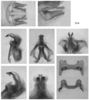 Melanoplus sylvestris Morse, 1904: male genitalia. (Otu).;Melanoplus sylvestris Morse, 1904: male genitalia. (Otu).