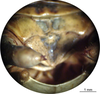 CollectionObject 1538276; d470b7a3-3766-4475-bd27-8b8a1454163e: male abdominal apex (holotype). (CollectionObject).