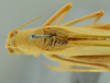 CollectionObject 1532178; 1adf74d6-67cd-4568-838a-21950ab0adc9: male stridulatory area, dorsal view (syntype). (CollectionObject).