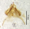 CollectionObject 1523743; 852b2548-7b18-4b91-b12b-5f20cb826618: male genitalia, ventral view (holotype). (CollectionObject).