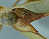 CollectionObject 1532255; c09be688-8ff6-4875-b7be-e5c37fd803ae: male stridulatory area, dorsal view (holotype). (CollectionObject).