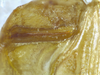 Tenerasphaga mbulu Hemp, 2018: male stridulatory file. (Otu).