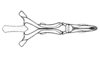 Zygoclistron superbum Rehn, 1907: Fig. 78. endophallus, dorsal view. (Otu).