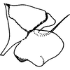 Pygofer, lateral view on Arboridia (Arboridia) cerna Dworakowska, 1977: Pygofer, lateral view. (Observation).