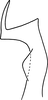 Stylus on Erythridula martini (Hepner, 1976): Stylus (holotype of E. brundusoides Hepner). (Observation).