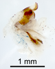 CollectionObject 1507480; a7baa946-634e-448d-8d86-36036ab641ae: Male genitalia, lateral view (holotype). (CollectionObject).