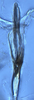 Aedeagus, ventral view: !! display not done !! on Matsumurasca (Solanasca) solana (DeLong, 1931): (Observation).