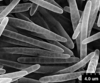 Brochosomes: !! display not done !! on Homalodisca lucernaria (Linnaeus, 1758): HD175 | Venezuela, Miranda, Presa el [Tauzpo?], 100 m., 10-V-1975, J. Salcedo, R. E. Dietz | USNM on loan from MIZA. (Observation).