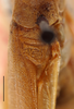 Phaulula laevis (Brunner von Wattenwyl, 1878): male, tegmen dorsal view, scale bar: 2 mm, Mambajas Misamis, Philippines, UPLBMNH. (Otu).