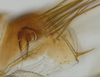 Pygofer, lateral view: (Observation).