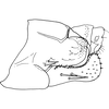 Pygofer, lateral view on Anufrievia expansa Cao & Zhang, 2018: Pygofer, lateral view. (Observation).