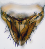 Subgenital plate: (Observation).;Subgenital plate: (Observation).