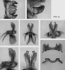 Melanoplus pinaleno Hebard, 1937: male genitalia. (Otu).