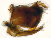 Pygofer, lateral view: (Observation).