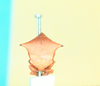 Head: !! display not done !! on Stictocephala constans (Walker, 1851): (Observation).