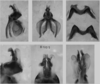 Melanoplus stupefactus (Scudder, 1876): male genitalia. (Otu).
