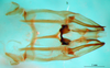 CollectionObject 1552389; 2a71a415-1861-4edd-84f7-2837bc7597fc: phallic complex, ventral view. (CollectionObject).