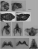 Melanoplus borealis (Fieber, 1853): male genitalia. (Otu).