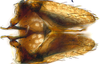 Subgenital plate: (Observation).