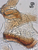 Anal tube processes on Bretega declispiverpa Stiller, 2017: Anal tube process. (Observation).