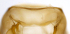 Other on Carapona vulta (DeLong & Freytag, 1975): Male [DZRJ]: valve, ventral view. (Observation).