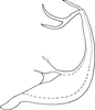 Aedeagus, lateral view on Edwardsiana ishidai (Matsumura, 1932): Aedeagus, lateral view (Sweden). (Observation).