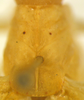 CollectionObject 1543806; 1dfade2e-bea3-4bb0-a6cb-8dcd913f5bfa: male pronotum, dorsal view (holotype). (CollectionObject).