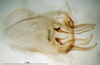 CollectionObject 1500759; 99e6c6e6-b70c-4df8-a157-40b8cd6e318e: phallic complex, dorsal view (holotype). (CollectionObject).