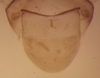Sternite VIII (male) on Rugosella obrienorum (Freytag & DeLong, 1971): Male holotype [OSU]: sternite VIII, ventral view. (Observation).