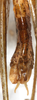 CollectionObject 1567661; NMW 13776, 2e86a9de-8e49-45ab-a606-03d0367d87a0: male abdomen tip, ventral view. (CollectionObject).