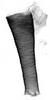 Aedeagus, lateral view.: Siphunculus (SI) of A. spiraecola. (Observation).