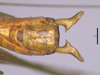 Male, subgenital plate. Depicts CollectionObject 2062466; 1ac04c84-f909-4b75-abaf-a60dd80b9dde, a CollectionObject.