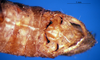 CollectionObject 1505381; a761a4b0-37c7-4b5a-98c4-3da1782ac157: male abdomen tip, dorsal view (syntype of Cranae marginata). (CollectionObject).