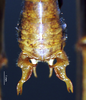 CollectionObject 1503227; 751d101e-5ddc-4878-9fb5-2d07cf13e1c2: male cerci. (CollectionObject).