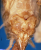 CollectionObject 1505251; b21d9754-0e2d-4f72-ad49-f7756d8c5db4: female abdomen tip, ventral view (holotype). (CollectionObject).