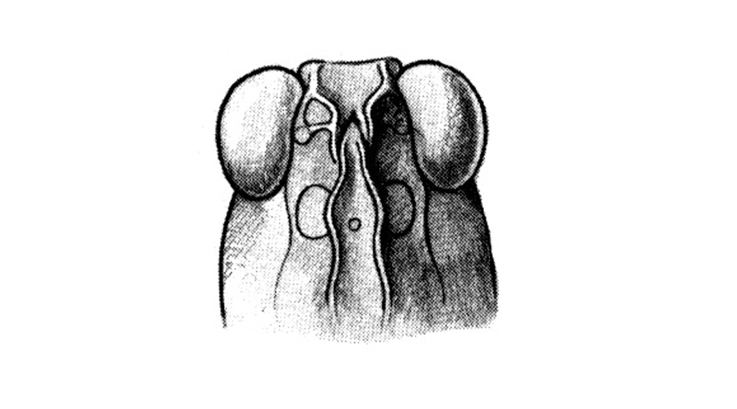 Fig. 64I. face. Depicts Mestobregma impexum Rehn, 1919, an Otu.