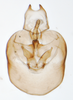 Pygofer, ventral view on Delphacodes apicatus Beamer, 1948: (Observation).