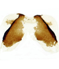 Forewing: <i> C. cuesta</i> Hamilton. Female internal sternum VIII.<br>Canada, B.C., Nelson, CNC.<br> Photo: S. Krishnankutty. (Observation).