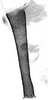 Aedeagus, lateral view.: Siphunculus (SI) of A. sambuci. (Observation).