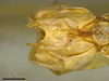 CollectionObject 2189003; 3e92da30-72d7-4127-a757-5a992b930552, ZUFMS ORT00844: Male postabdomen, ventral view. (CollectionObject).